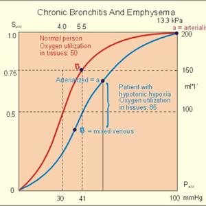 How To Clear Catarrah - Toddler Bronchitis