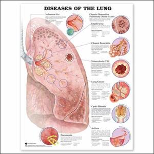 Bronchitis Aftermath - Gender Differences And Chronic Bronchitis Better Indicators Of COPD Exacerbations