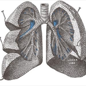 How To Treat Bronchitis Naturally - Lung Cleansing For Smokers To Avoid A Sticky Fate