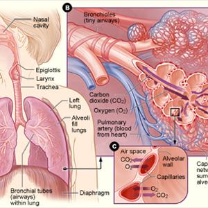 Homeopathic Medicine For Bronchitis - Lung Infections